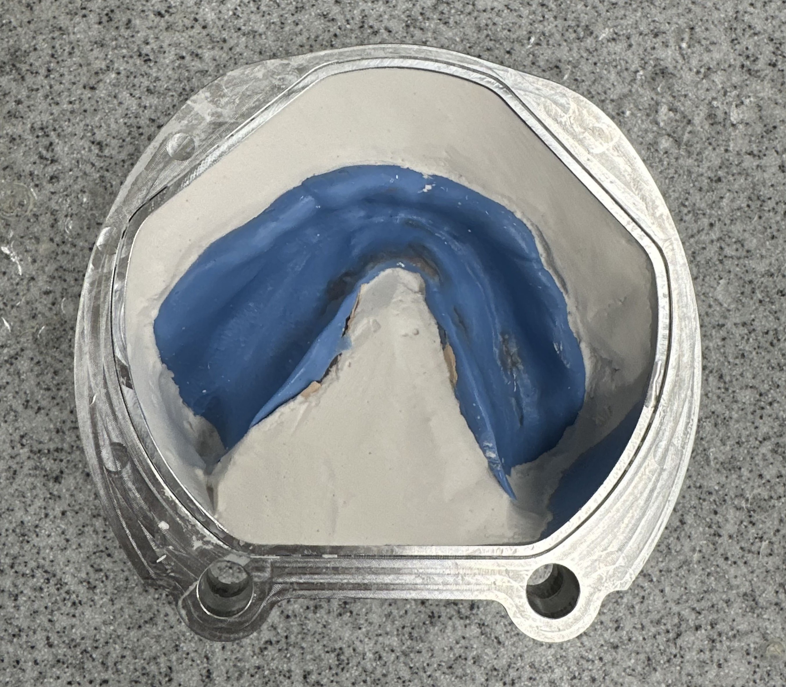 Unfinished denture reline before milling