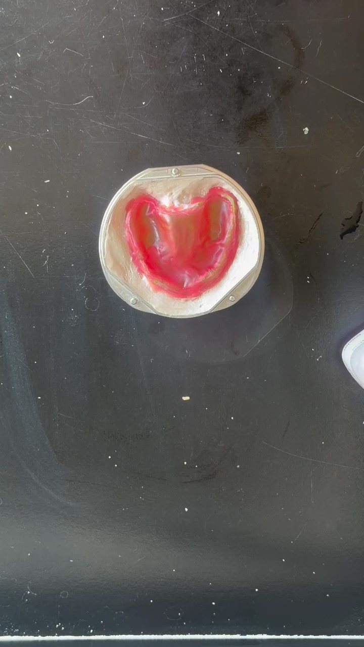 Wax-up seated in plaster in the flask base